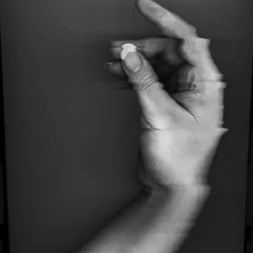 A scanned image of a hand