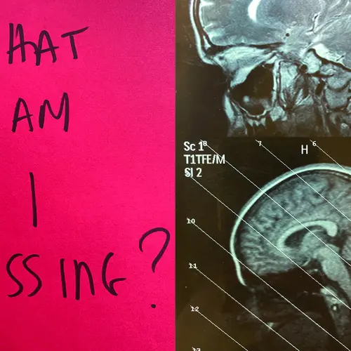 Magazine spread wiht hand written text on one side and two x-rays of skulls on the other.