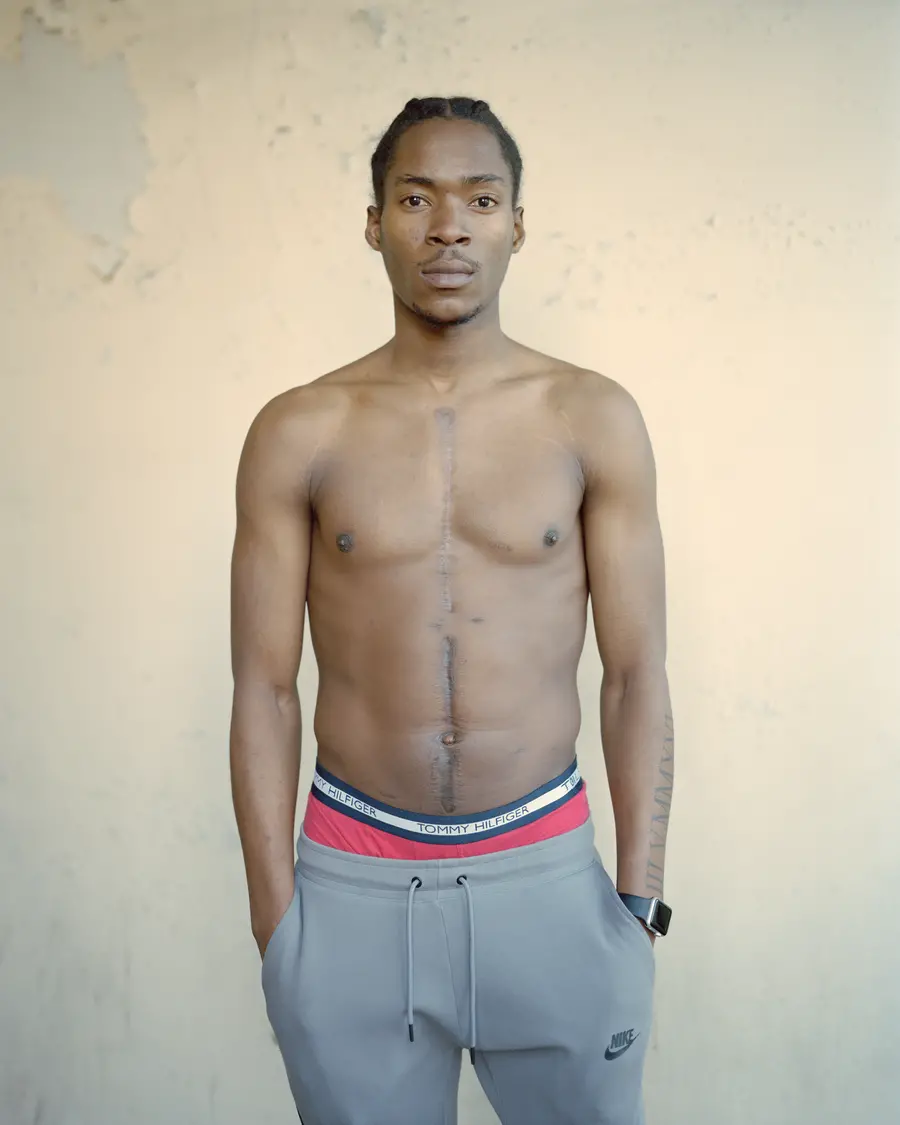 A colour mid-shot portrait of a young black man stood with grey tracksuit bottoms on. He stands topless looking directly into the lens with a calm but firm expression on his face. A visible scar runs from between his collar bones down to just below his navel. 