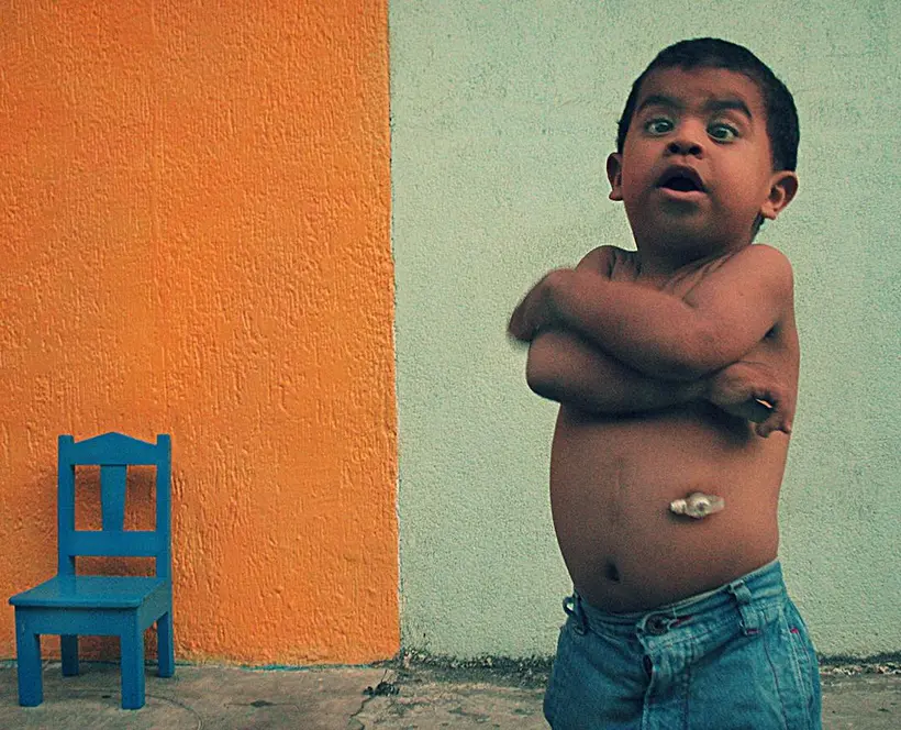An image of the photographer's son, Ulysses, who has Costello syndrome, a very rare genetic disorder. Ulysses is pictured folding his arms against a vibrant orange and mint green backdrop. A tiny blue chair sits in the background.